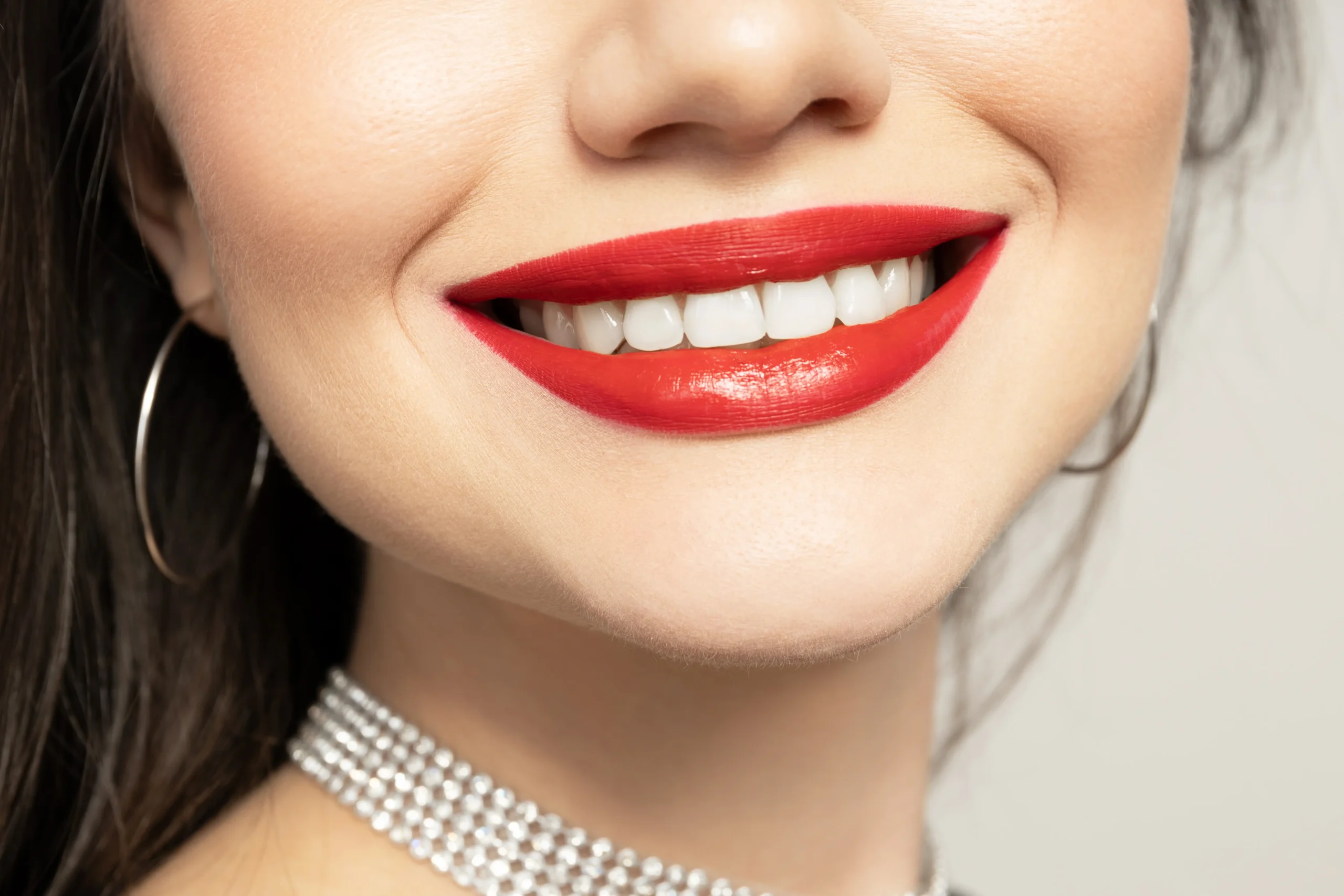 What Is a Hollywood Smile? Your Guide to the Iconic Look